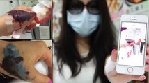 Penghapusan tato gagal membuat bekas luka hitam di tangan wanita - Tomonews