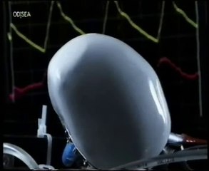Bioprotesis: Corazones roboticos