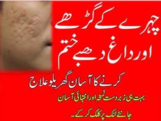 Chehre Ke Gadde Aur Daag Dhabe Door Karne Ka Asan Gharelu Ilaj  Removing Acne Scars