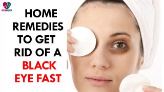 Home Remedies to Get Rid of a Black Eye Fast - Health Sutra