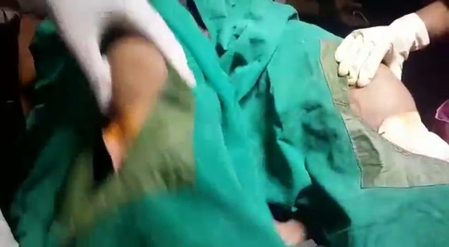 Stem Cell Injections for Knee Osteoarthritis | The Magic Cell | Non-surgical Knee Osteoarthritis Treatment