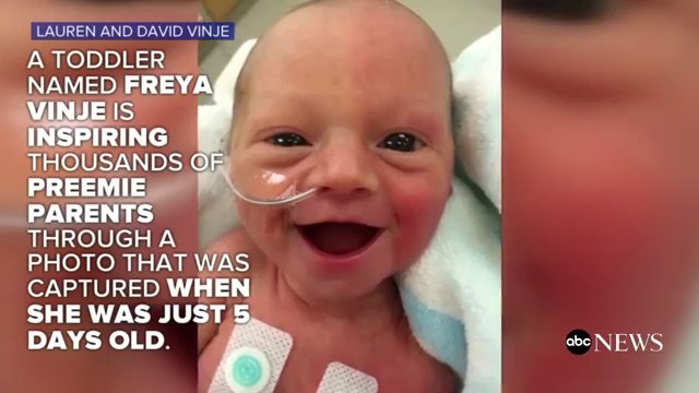 Regardez le sourire de ce bébé prématuré! Trop tot sorti et pourtant si heureux