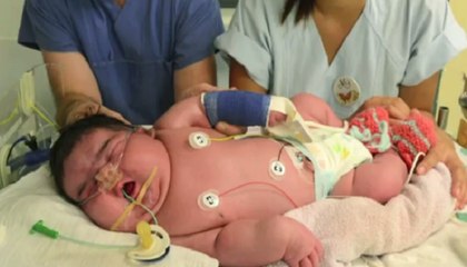 World’s Biggest Babies Ever Born