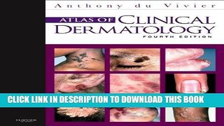 Read Now Atlas of Clinical Dermatology, 4e (du Vivier, Atlas of Clinical Dermatology) Download Book
