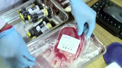 Cord Blood Stem Cell Banking - Cryoviva India
