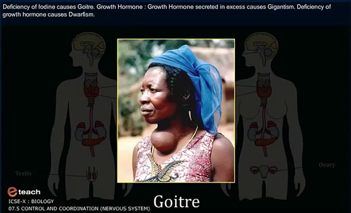 ICSE Class 10: CBSE Animated Video Lessons-SCIENCE NERVOUS SYSTEM 1