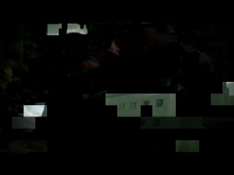 Advanced Brain Tumor Surgery at Wockhardt Hospital India