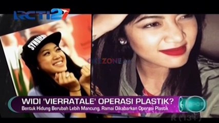 Widi 'Vierratale' Oplas?