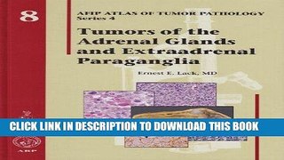 Read Now Tumors of the Adrenal Glands and Extraadrenal Paraganglia - Volume 8 (Afip Atlas of Tumor