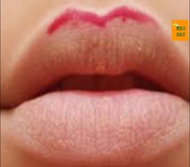 Tướng phụ nữ dâm đãng, hay ngoại tình | Meohaynhat