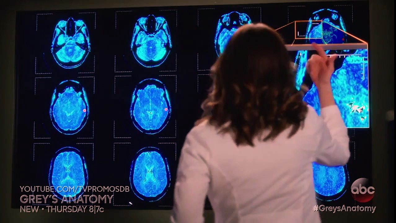 Grey's Anatomy 13x06 Sneak Peek -Roar- (HD)