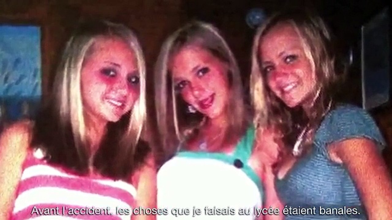 Défigurée à cause d'une chose que nombreux d'entre nous font, elle livre un message bien touchant