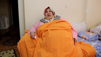 Obezite Hastası Kadın Sağlığına Kavuşmak Istiyor