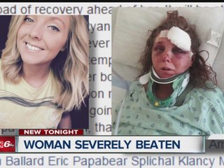 Woman severely beaten, ex-boyfriend charged