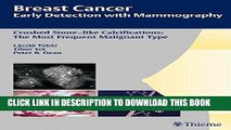 Ebook Breast Cancer: Early Detection with Mammography: Crushed Stone-like Calcifications: The Most