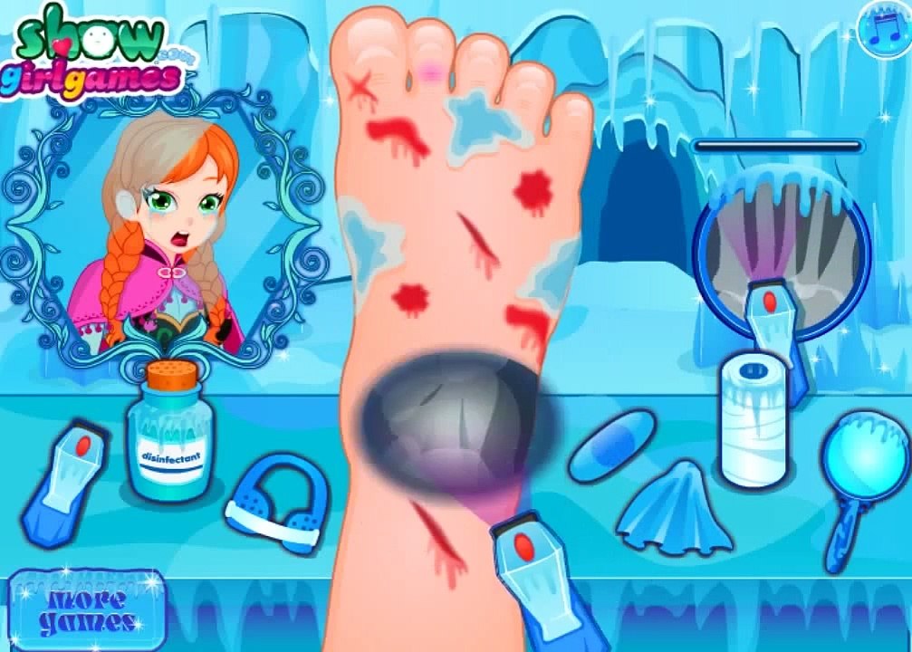 Лечим ногу Анне! Развивающие игры для детей! Игры для девочек!