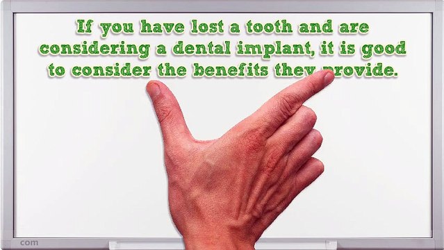 The Benefits of Dental Implants