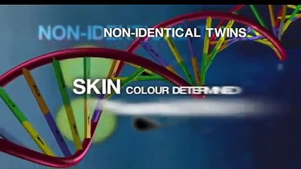 Black and white twins born for the second time in the same family!