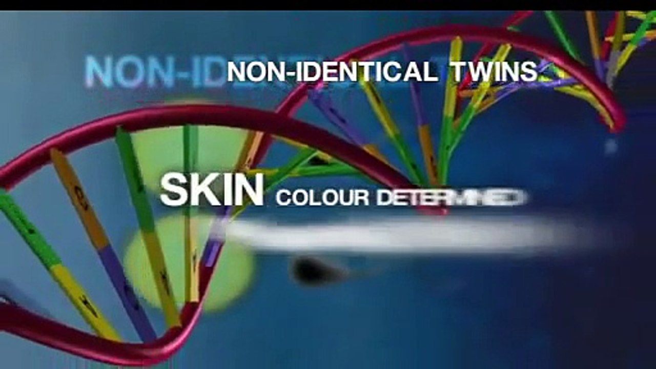 Black and white twins born for the second time in the same family!
