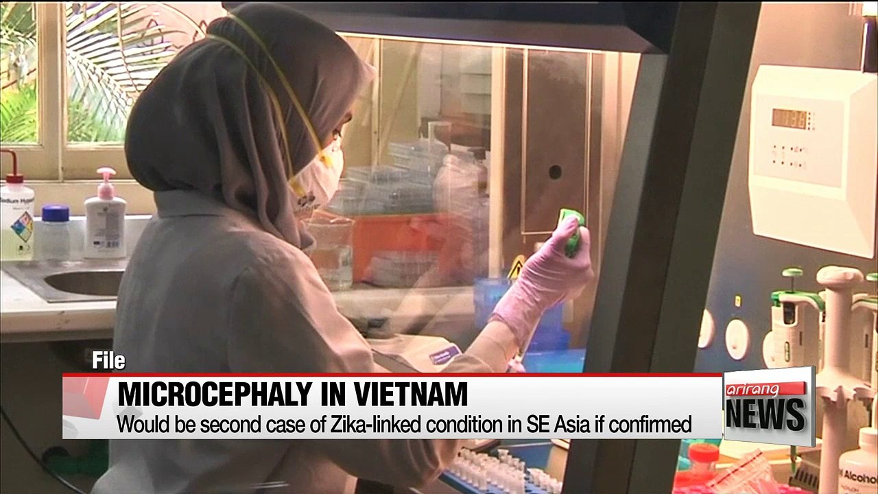 First Zika-linked microcephaly case reported in Vietnam