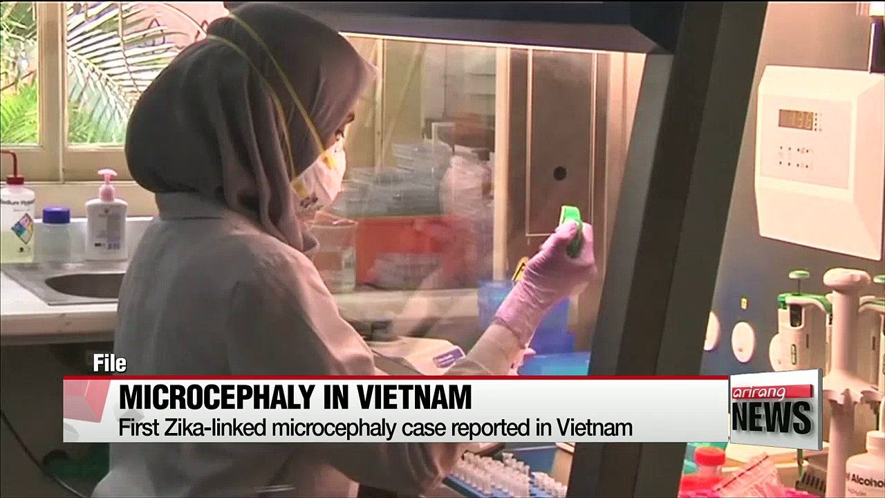 First Zika-linked microcephaly case reported in Vietnam