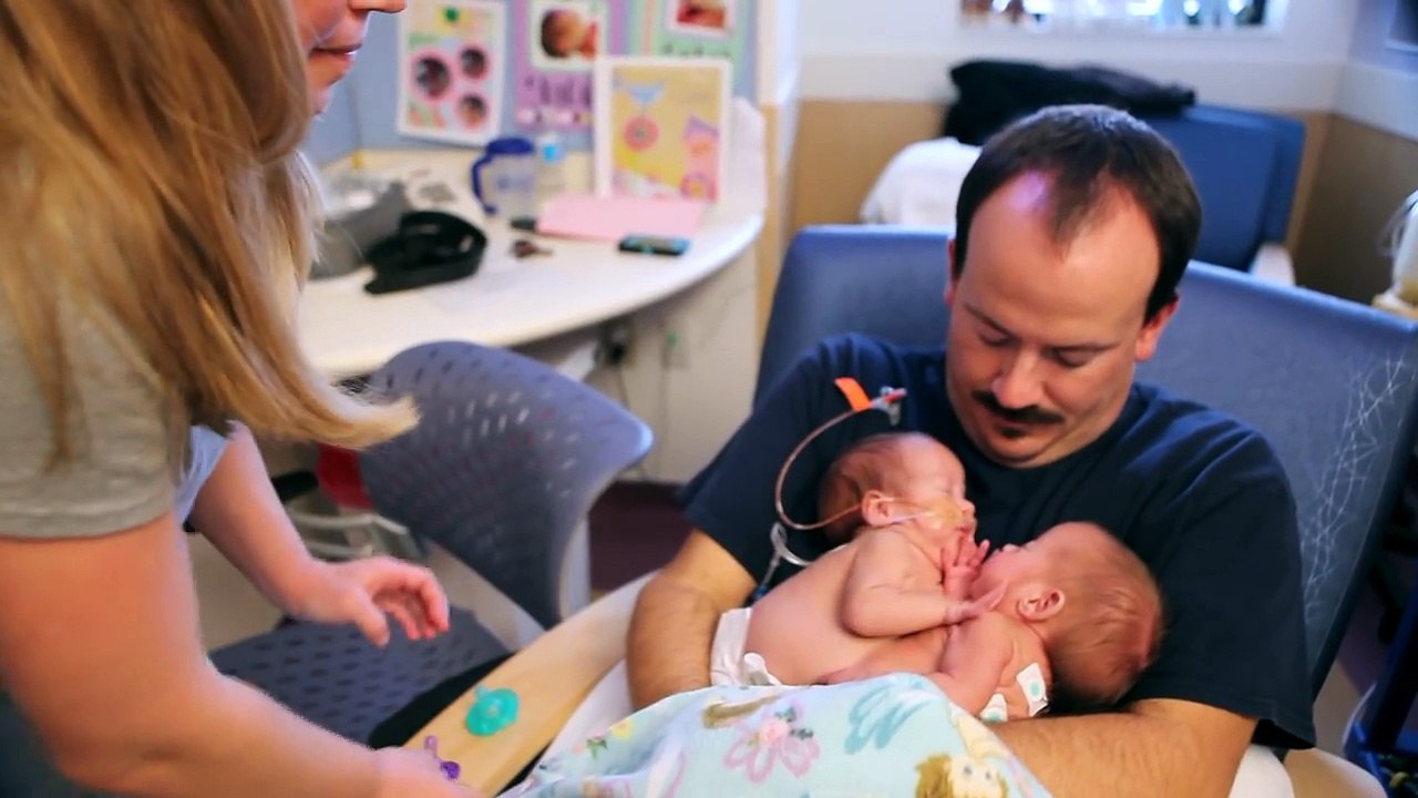 Leurs chances de survie étaient estimées à 20 % et leurs parents acceptent de les séparer. 2 ans plus tard... Wow !