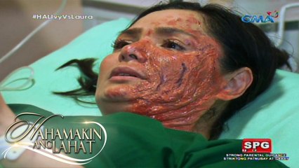 Hahamakin ang Lahat: Sunog na mukha