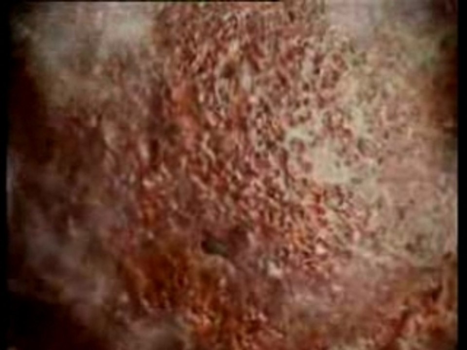 La cigarette vous détruit les poumons