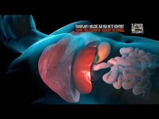 Jo vetem mode - Transplanti i melcise ne spitalin "Acibadem" ne Stamboll! (29 tetor 2016)