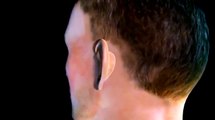 Meltem Hastanesi | Kepçe Kulak Ameliyatı Nasıl Yapılır?