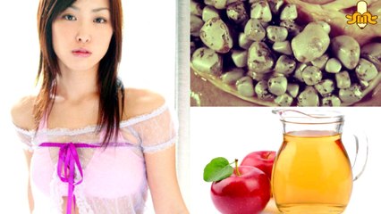 ➥ Una Amiga China REVELA Cómo ELIMINAR LAS PIEDRAS DE LA VESÍCULA en Sólo 7 DÍAS!!