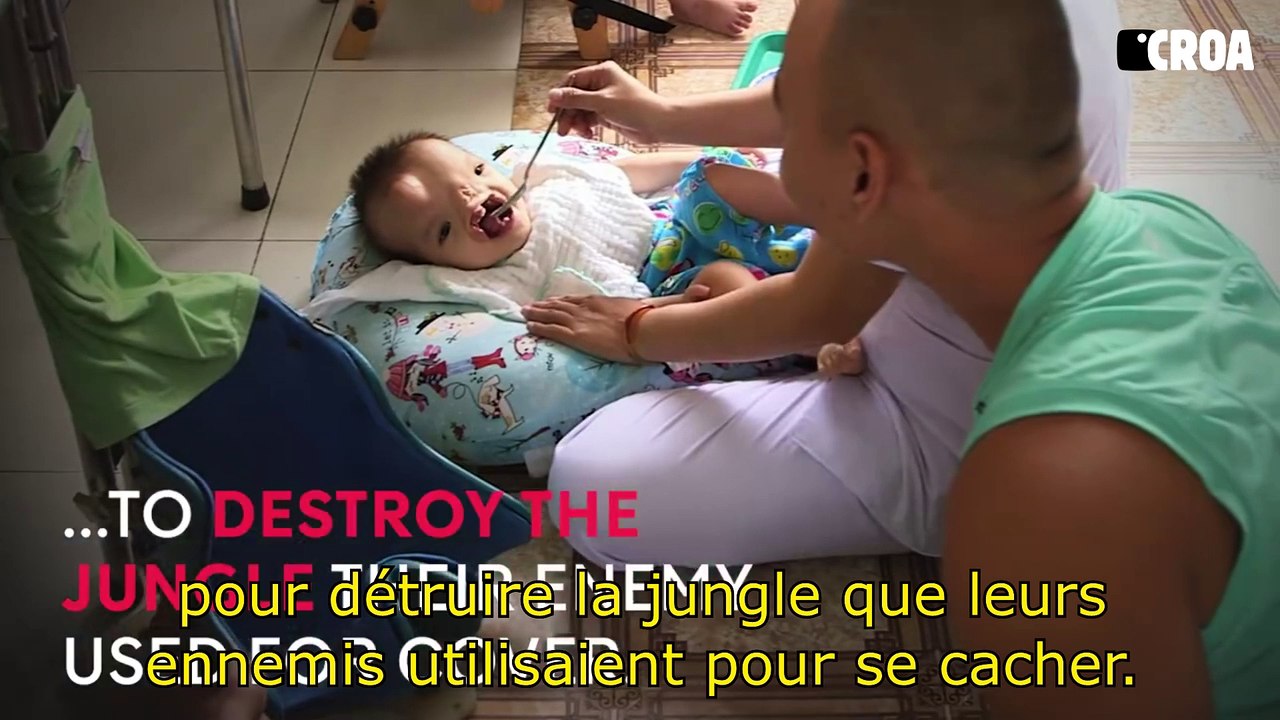 Vietnam : les conséquences encore visibles de l'agent orange sur... des bébés !