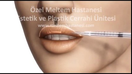 Meltem Hastanesi | Dudak Dolgusu Nasıl Yapılır?