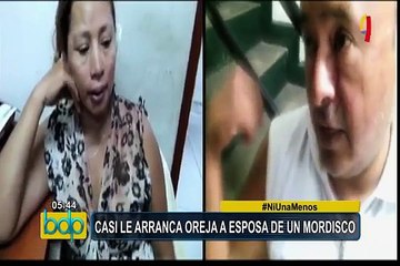 Iquitos: sujeto golpeó y casi le arranca la oreja a su esposa