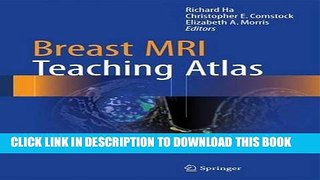 [PDF] Breast MRI Teaching Atlas Full Online
