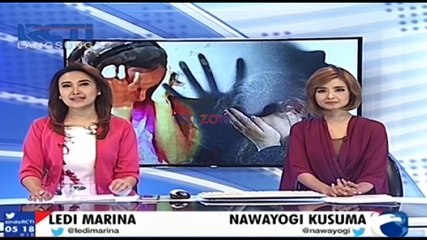 Mahasiswi Cantik Disiram Air Keras oleh Orang Tak Dikenal di Bandung Jawa Barat
