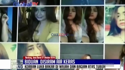 下载视频: Seorang Biduan Disiram Air Keras di Bandung