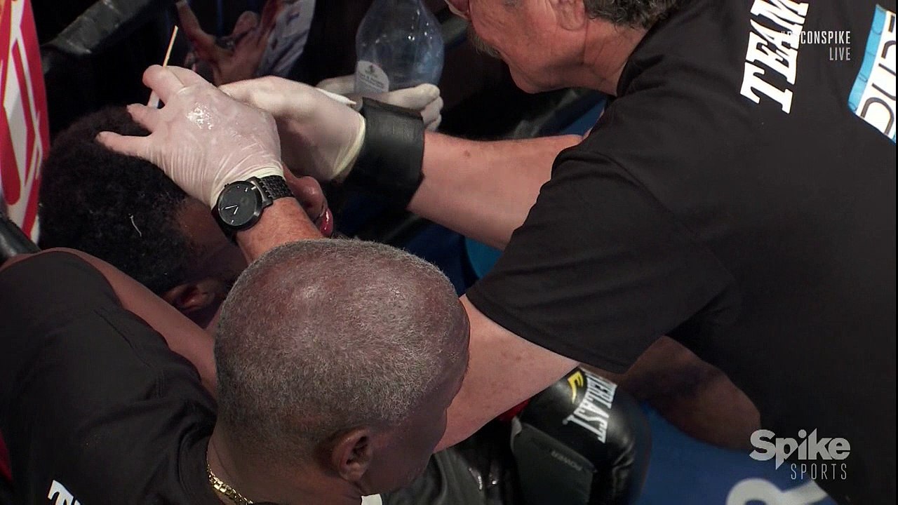 Rances Barthelemy vs. Mickey Bey Jr. 03.06.2016 HD Part 2