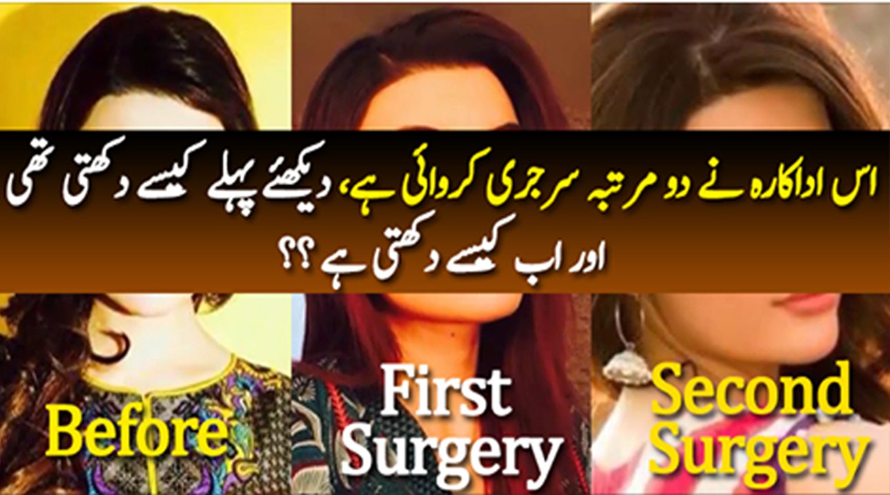 This Actress Have Been Through 2 Plastic Surgeries, See How She Look Then and Now