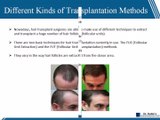 Hair Loss Treatments and Hair Transplantation