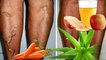 ✓✓A Dermatologist Showed Me These Home Remedies To REMOVE VARICOSE VEINS of the legs!!