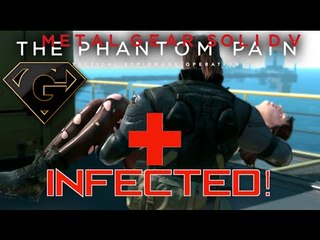 MGSV: TPP Tips - What To Do When You Get Infected