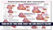 [FREE] EBOOK Heart Disease Anatomical Chart in Spanish (Enfermedad del corazÃ³n) (Spanish Edition)