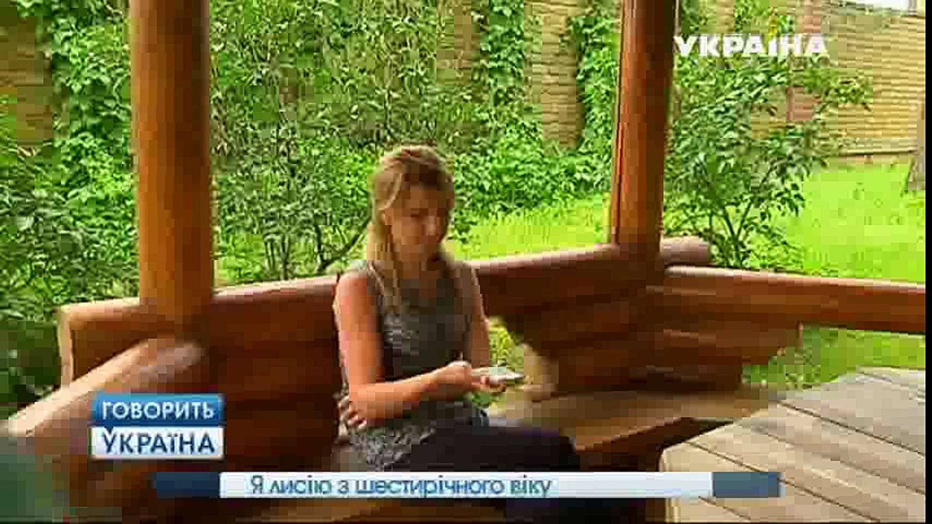 Я лысею с 6 лет (полный выпуск) | Говорить Україна part 2/2