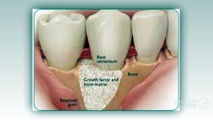 Portland dental care and implant center- Top Dental clinic in Portland