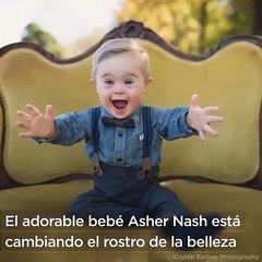 No lo aceptaban como modelo por tener Síndrome de Down y ahora revoluciona las redes!