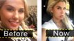 Ivanka Trump fans  go under the knife to  look like her