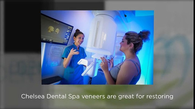Dental Veneers
