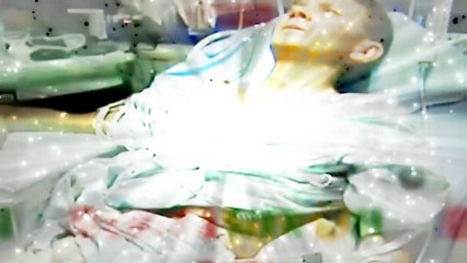 Badai Menyebabkan Ular PALING MEMATIKAN Jenis Langka ini MUNCUL MEMBUAT PANIK WARGA