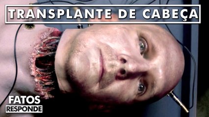 Transplante de cabeça acontecerá em 2017
